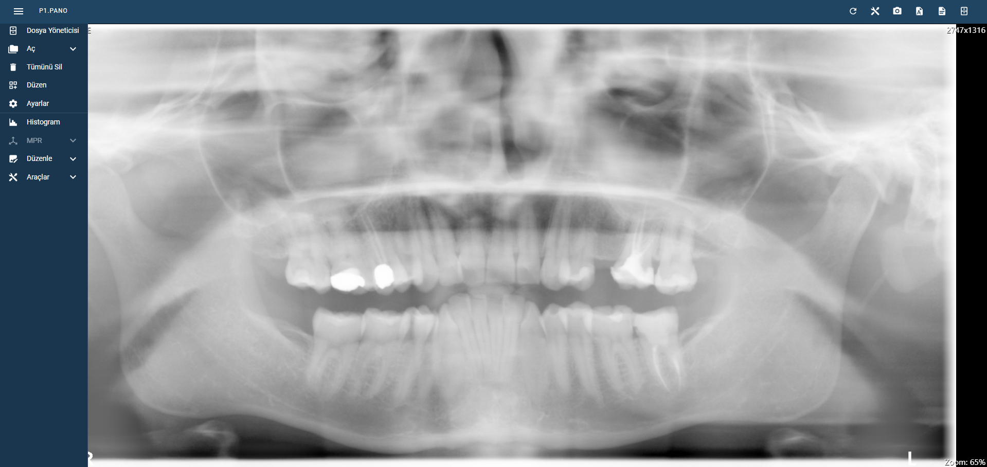 X-RAY Systems Test'te